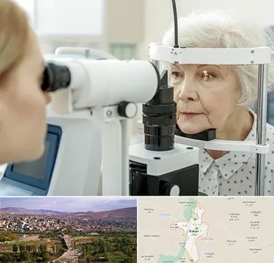 چشم پزشک خانم در بوکان