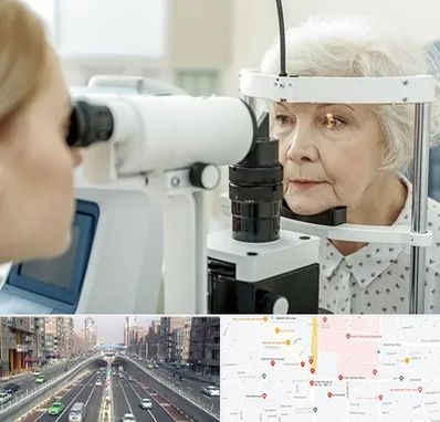 چشم پزشک خانم در توحید 