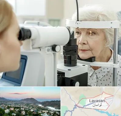 چشم پزشک خانم در لواسان