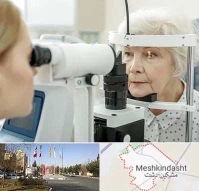 چشم پزشک خانم در مشکین دشت