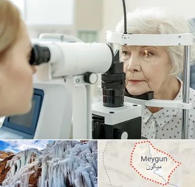 چشم پزشک خانم در میگون
