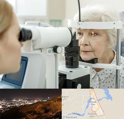 چشم پزشک خانم در میناب