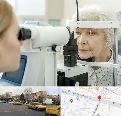 چشم پزشک خانم در شهناز تبریز