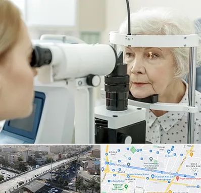 چشم پزشک خانم در فرجام 