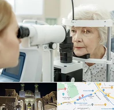 چشم پزشک خانم در زرگری شیراز 