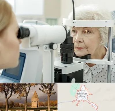 چشم پزشک خانم در تویسرکان