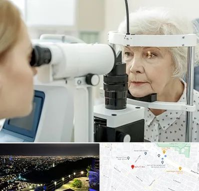 چشم پزشک خانم در هفت تیر مشهد 