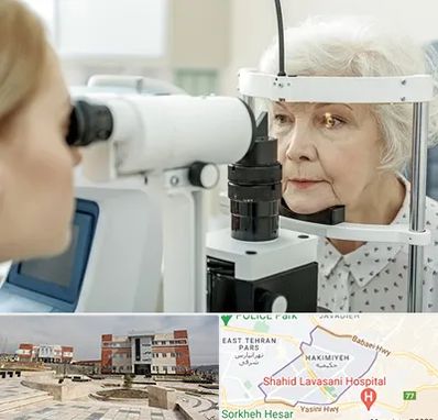 چشم پزشک خانم در حکیمیه 