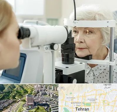 چشم پزشک خانم در شمال تهران 