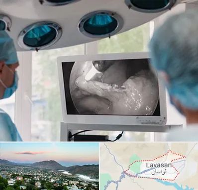 جراح ریه در لواسان