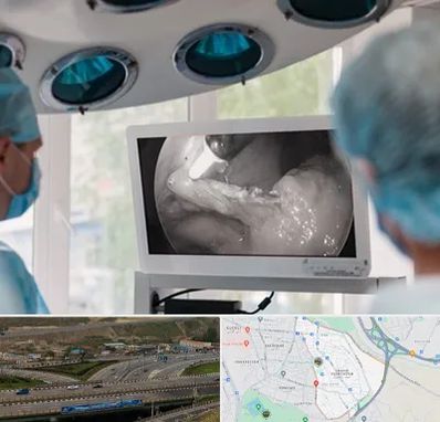 جراح ریه در یاغچیان تبریز