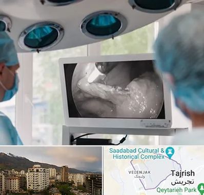 جراح ریه در زعفرانیه 