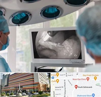 جراح ریه در سهروردی 