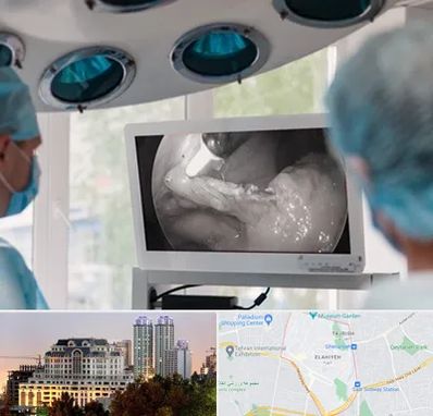 جراح ریه در فرشته 