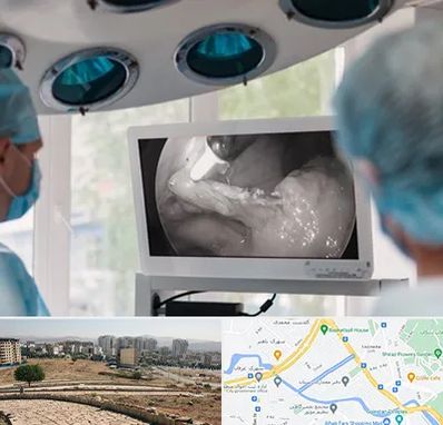 جراح ریه در کوی وحدت شیراز 