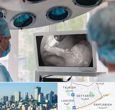 جراح ریه در قیطریه 