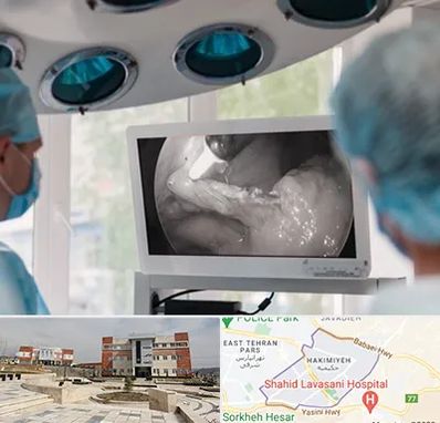 جراح ریه در حکیمیه 