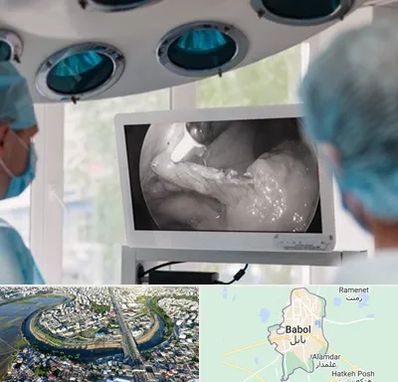 جراح ریه در بابل