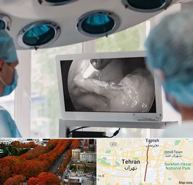 جراح ریه در ولیعصر 