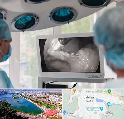 جراح ریه در لاهیجان