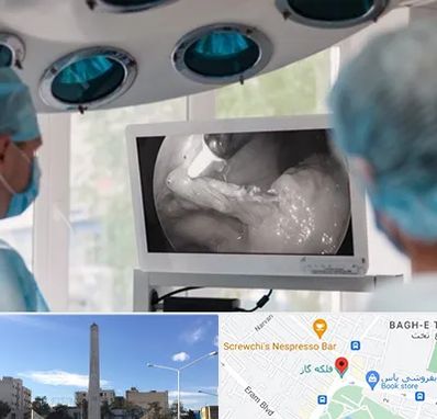 جراح ریه در فلکه گاز شیراز 