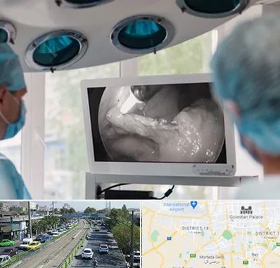 جراح ریه در جنوب تهران 