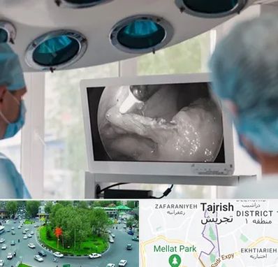 جراح ریه در تجریش 