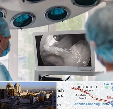 جراح ریه در فرمانیه 