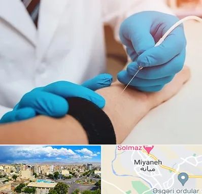 مرکز نوار عصب و عضله در میانه