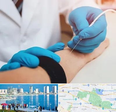 مرکز نوار عصب و عضله در چیتگر 