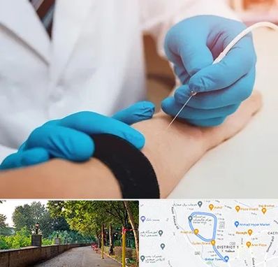 مرکز نوار عصب و عضله در فلکه گاز رشت 