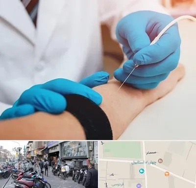 مرکز نوار عصب و عضله در چهارراه استانبول