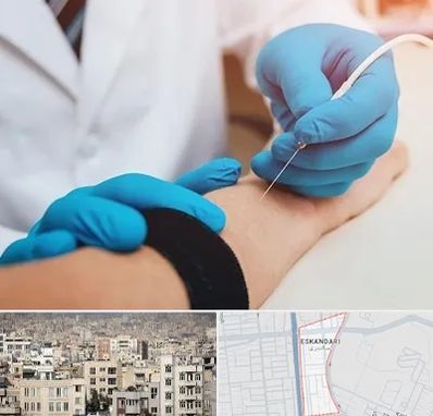 مرکز نوار عصب و عضله در اسکندری