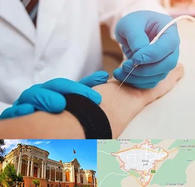 مرکز نوار عصب و عضله در خوی