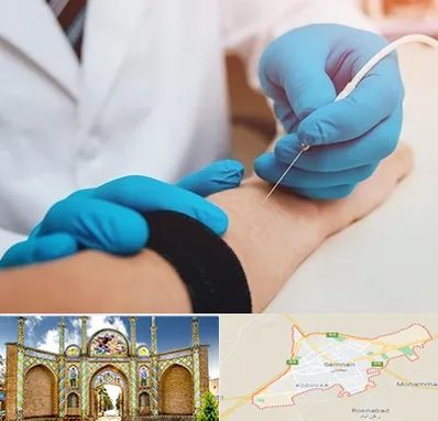 مرکز نوار عصب و عضله در سمنان