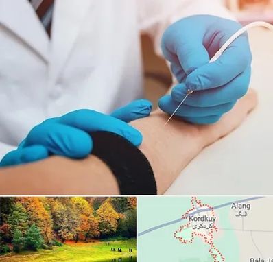 مرکز نوار عصب و عضله در کردکوی