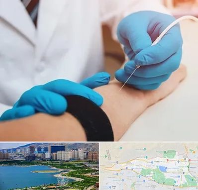 مرکز نوار عصب و عضله در منطقه 22 تهران 