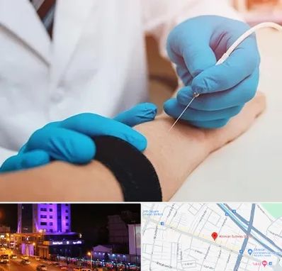 مرکز نوار عصب و عضله در آبرسان تبریز