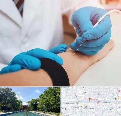 مرکز نوار عصب و عضله در هشت بهشت اصفهان 