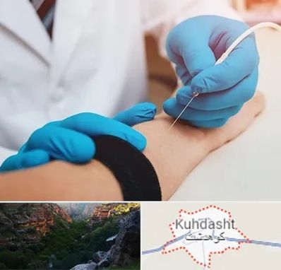 مرکز نوار عصب و عضله در کوهدشت