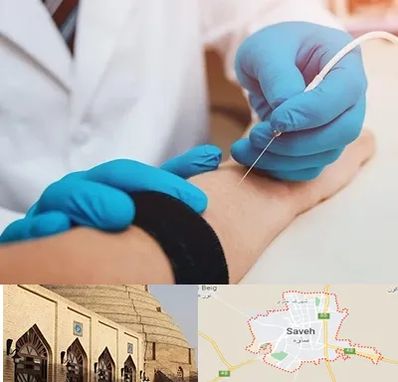 مرکز نوار عصب و عضله در ساوه