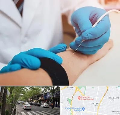 مرکز نوار عصب و عضله در ظفر 