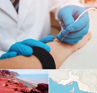 مرکز نوار عصب و عضله در هرمزگان