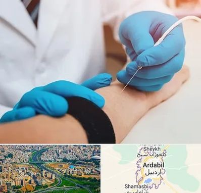 مرکز نوار عصب و عضله در اردبیل