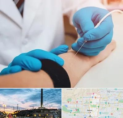 مرکز نوار عصب و عضله در منطقه 2 تهران 