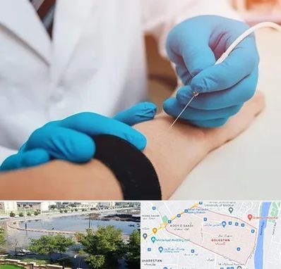 مرکز نوار عصب و عضله در گلستان اهواز 