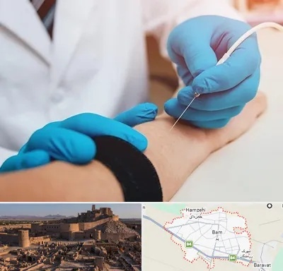 مرکز نوار عصب و عضله در بم