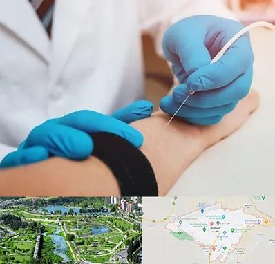 مرکز نوار عصب و عضله در بجنورد