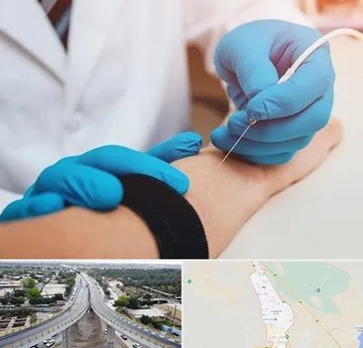مرکز نوار عصب و عضله در اندیمشک