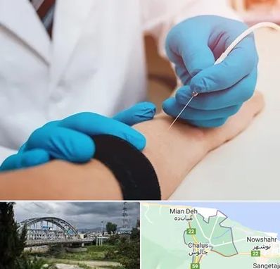 مرکز نوار عصب و عضله در چالوس